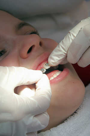 Child at the orthodontist